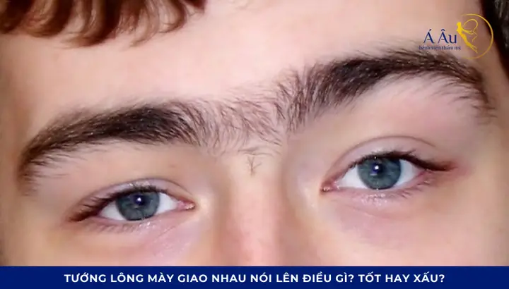 Giải Mã Tướng Lông Mày Nối Nhau (giao Nhau): Tốt Hay Xấu Và Ý Nghĩa Ở Nam, Nữ Giải Mã Tướng Lông Mày Nối Nhau (giao Nhau): Tốt Hay Xấu Và Ý Nghĩa Ở Nam, Nữ