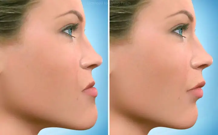 Xem Tướng Mặt Gãy (mặt Lưỡi Cày): Giải Mã Tính Cách, Số Vận Nam Nữ & Có Tốt Không? Xem Tướng Mặt Gãy (mặt Lưỡi Cày): Giải Mã Tính Cách, Số Vận Nam Nữ & Có Tốt Không?