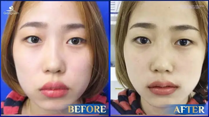 Giải Mã Tướng Số Môi Trên Dày Hơn Môi Dưới: Tốt Hay Xấu Và Vận Mệnh Của Bạn Giải Mã Tướng Số Môi Trên Dày Hơn Môi Dưới: Tốt Hay Xấu Và Vận Mệnh Của Bạn