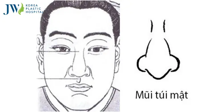 Xem Tướng Mũi Túi Mật: Ý Nghĩa Vận Mệnh Theo Nhân Tướng Học