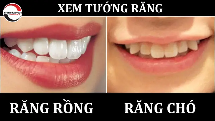 Xem Tướng Răng Chó (răng Nanh): Ý Nghĩa Nhân Tướng, Tính Cách, Vận Mệnh & Cách Khắc Phục Y Khoa Xem Tướng Răng Chó (răng Nanh): Ý Nghĩa Nhân Tướng, Tính Cách, Vận Mệnh & Cách Khắc Phục Y Khoa