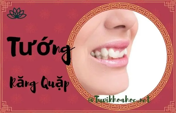Xem Tướng Răng Quặp: Luận Giải Ý Nghĩa Số Mệnh, Tính Cách Nam Nữ Chi Tiết