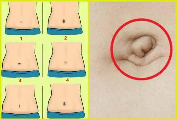 Xem Tướng Rốn Nữ: Giải Mã Ý Nghĩa 7+ Loại Rốn Về Vận Mệnh, Phúc Lộc Và Tình Duyên