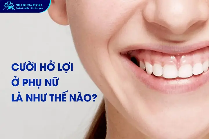 Giải Mã Tướng Số Phụ Nữ Cười Hở Lợi: Tốt Hay Xấu Theo Nhân Tướng Học