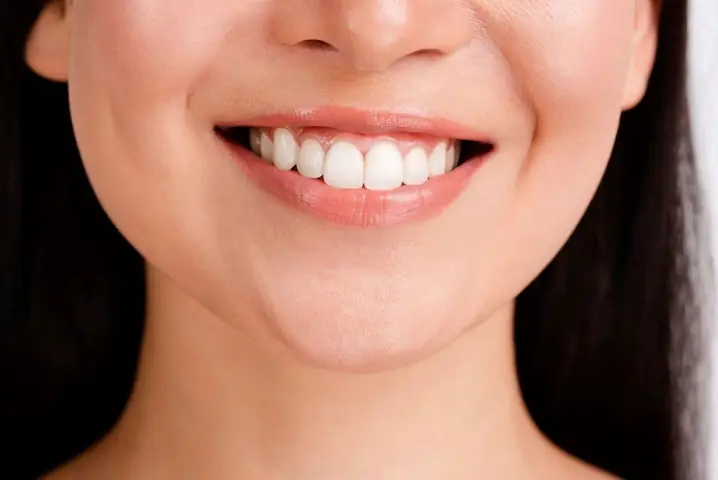 Giải Mã Tướng Số Phụ Nữ Cười Hở Lợi: Tốt Hay Xấu Theo Nhân Tướng Học