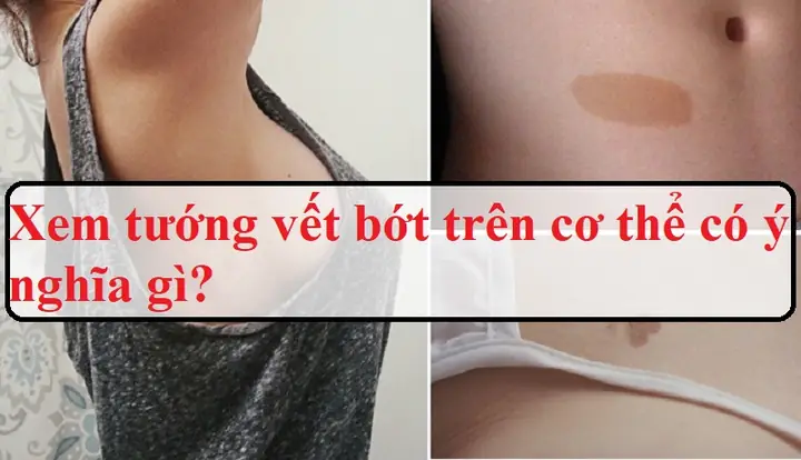 Xem Tướng Số Qua Vết Bớt Trên Cơ Thể: Ý Nghĩa Vận Mệnh, Tiền Tài Theo Nhân Tướng Học Xem Tướng Số Qua Vết Bớt Trên Cơ Thể: Ý Nghĩa Vận Mệnh, Tiền Tài Theo Nhân Tướng Học