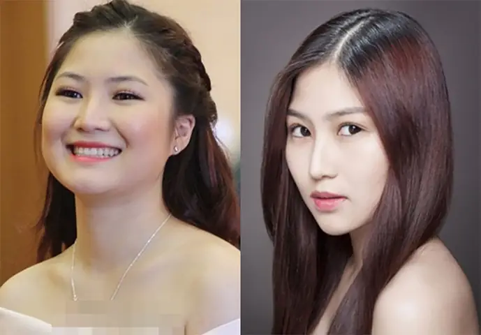 Xem Tướng Sửa Mũi Ở Đầu: Những Dáng Mũi Phú Quý Không Nên Can Thiệp Thẩm Mỹ Xem Tướng Sửa Mũi Ở Đầu: Những Dáng Mũi Phú Quý Không Nên Can Thiệp Thẩm Mỹ