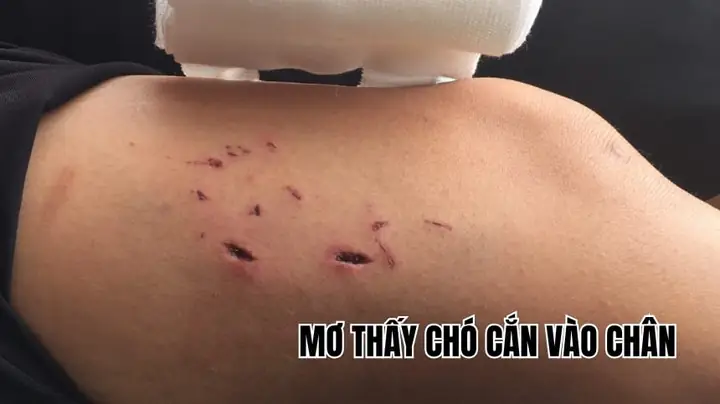 Giải Mã Ý Nghĩa Giấc Mơ Bị Chó Cắn: Điềm Báo, Nguyên Nhân Và Cách Đối Phó Giải Mã Ý Nghĩa Giấc Mơ Bị Chó Cắn: Điềm Báo, Nguyên Nhân Và Cách Đối Phó