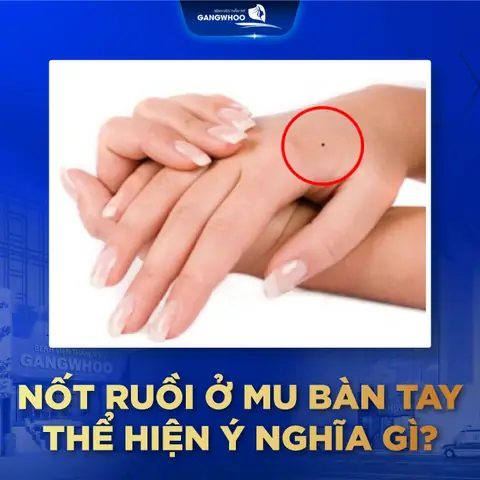 Giải Mã Ý Nghĩa Vị Trí Nốt Ruồi Trên Bàn Tay Theo Nhân Tướng Học Giải Mã Ý Nghĩa Vị Trí Nốt Ruồi Trên Bàn Tay Theo Nhân Tướng Học