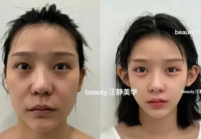 100+ Ảnh 2 Cô Gái Trung Quốc Đẹp Tuyệt Trần, Hình Nền Bestie 4k 100+ Ảnh 2 Cô Gái Trung Quốc Đẹp Tuyệt Trần, Hình Nền Bestie 4k