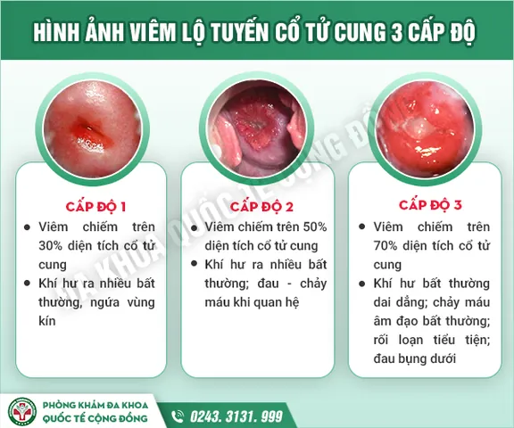 999+ Ảnh Ảnh Bé Gái Khoe Vùng Kín Facebook Mới Nhất Hiện Nay