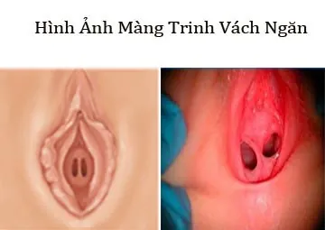 100+ Ảnh Bướm Gái Việt Nam Còn Trinh Full 4k Chill Tuyệt Đẹp