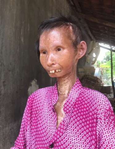 100+ Ảnh Chế Bà Già Và Cô Gái Hài Hước, Meme So Sánh Cực Hay