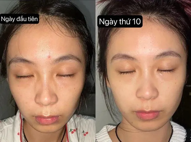 100+ Ảnh Cô Gái Chăm Sóc Da Đẹp Nhất, Hình Nền Skincare Chill Cực Chất