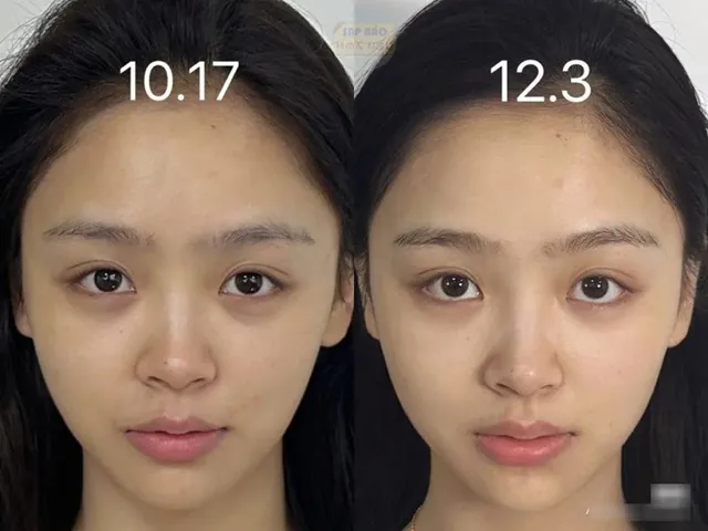 100+ Ảnh Cô Gái Chăm Sóc Da Đẹp Nhất, Hình Nền Skincare Chill Cực Chất