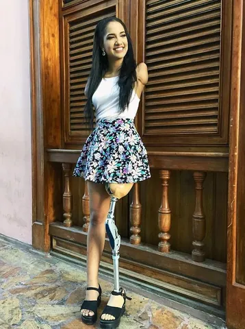 100+ Ảnh Cô Gái Cụt Tay Chân Dung Nghệ Thuật Đẹp 100+ Ảnh Cô Gái Cụt Tay Chân Dung Nghệ Thuật Đẹp