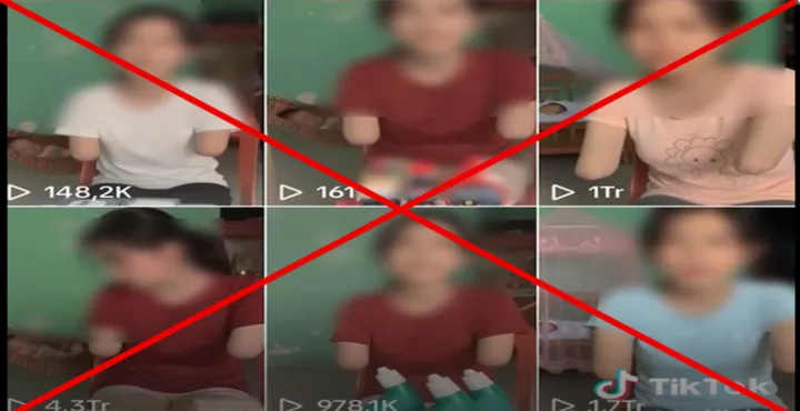 100+ Ảnh Cô Gái Cụt Tay Chân Dung Nghệ Thuật Đẹp 100+ Ảnh Cô Gái Cụt Tay Chân Dung Nghệ Thuật Đẹp