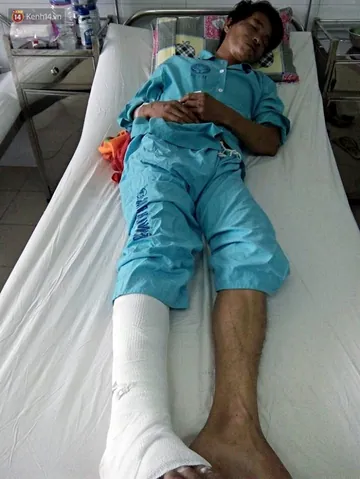 100+ Ảnh Cô Gái Cụt Tay Chân Dung Nghệ Thuật Đẹp 100+ Ảnh Cô Gái Cụt Tay Chân Dung Nghệ Thuật Đẹp