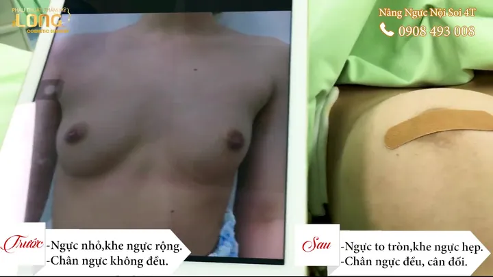 999+ Ảnh Ảnh Cô Gái Nâng Ngực Tử Vong Không Che Mới Nhất Hiện Nay