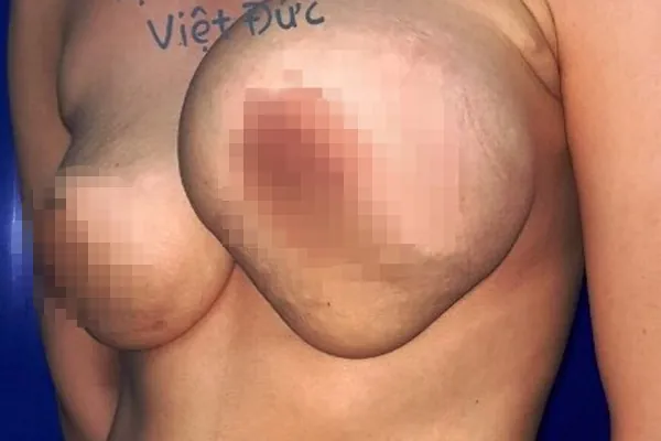 999+ Ảnh Ảnh Cô Gái Nâng Ngực Tử Vong Không Che Mới Nhất Hiện Nay