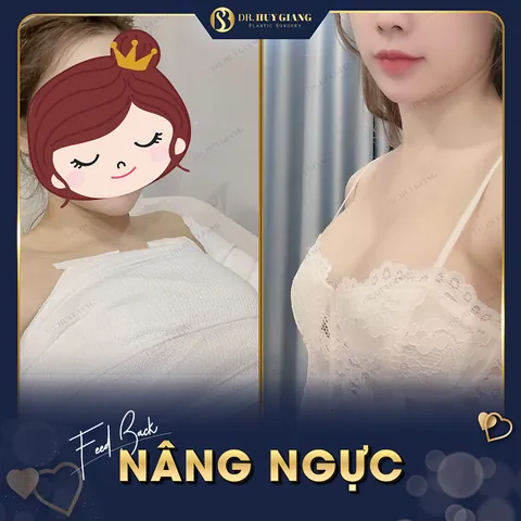 999+ Ảnh Ảnh Cô Gái Nâng Ngực Tử Vong Không Che Mới Nhất Hiện Nay