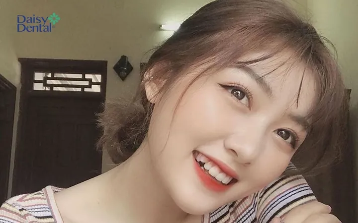 100+ Ảnh Con Gái Đẹp Cô Gái Răng Khểnh Nụ Cười Chữa Lành, Hình Nền 4k Cực Chất