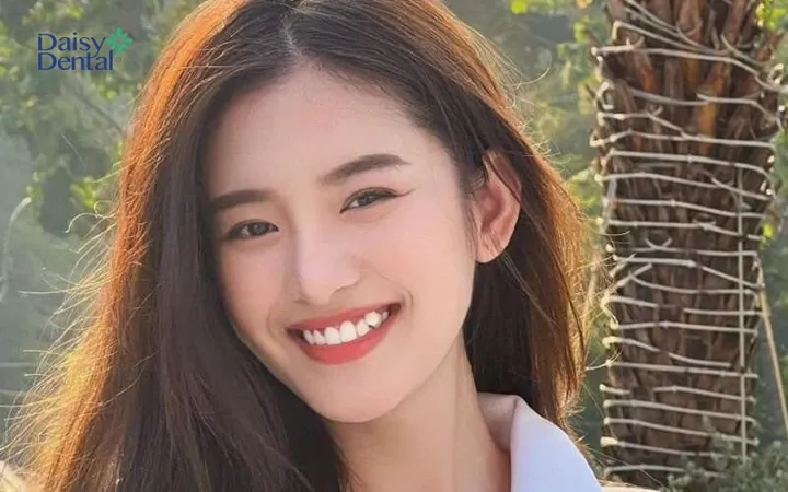 100+ Ảnh Con Gái Đẹp Cô Gái Răng Khểnh Nụ Cười Chữa Lành, Hình Nền 4k Cực Chất