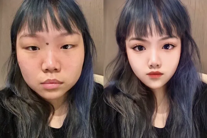 100+ Ảnh Con Gái Mặt Mụn Trước Sau Photoshop Cực Sốc, Đẹp Nhất