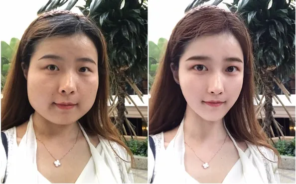 100+ Ảnh Con Gái Mặt Mụn Trước Sau Photoshop Cực Sốc, Đẹp Nhất