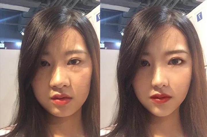 100+ Ảnh Con Gái Mặt Mụn Trước Sau Photoshop Cực Sốc, Đẹp Nhất