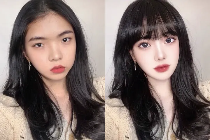 100+ Ảnh Con Gái Mặt Mụn Trước Sau Photoshop Cực Sốc, Đẹp Nhất