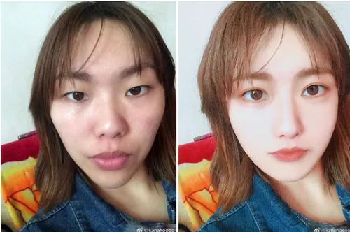 100+ Ảnh Con Gái Mặt Mụn Trước Sau Photoshop Cực Sốc, Đẹp Nhất