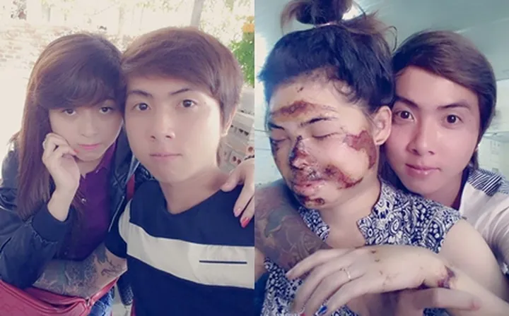 100+ Ảnh Con Trai Để Cằm Lên Đầu Con Ngây Ngọt, Cực Chill