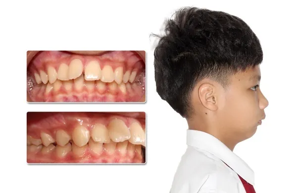 100+ Ảnh Con Trai Để Cằm Lên Đầu Con Ngây Ngọt, Cực Chill