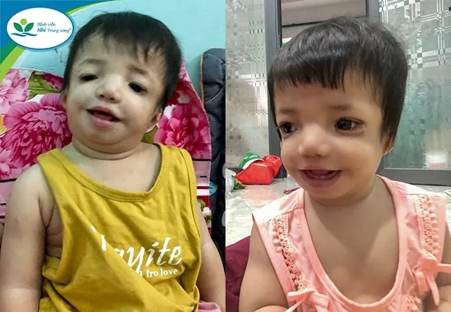 100+ Ảnh Con Trai Để Cằm Lên Đầu Con Ngây Ngọt, Cực Chill