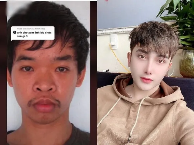 100+ Ảnh Con Trai Để Cằm Lên Đầu Con Ngây Ngọt, Cực Chill