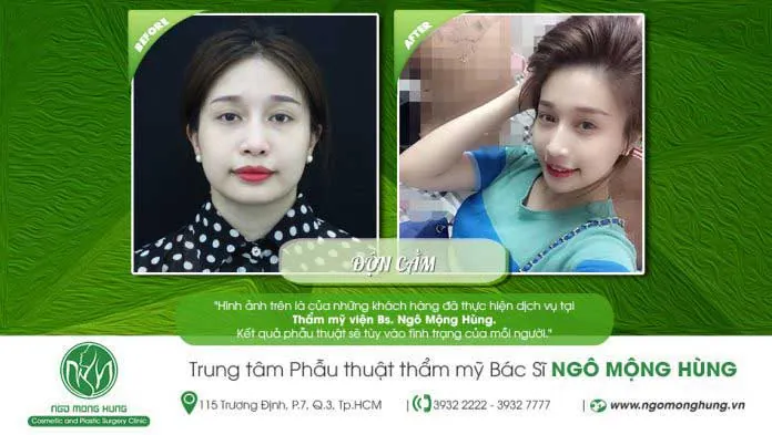 100+ Ảnh Con Trai Để Cằm Lên Đầu Con Ngây Ngọt, Cực Chill