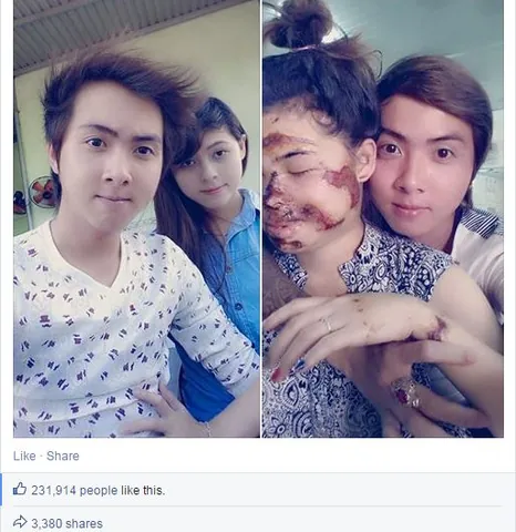 100+ Ảnh Con Trai Để Cằm Lên Đầu Con Ngây Ngọt, Cực Chill