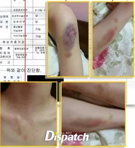 100+ Hình Ảnh Bạn Gái Của Kim Hyun Joong Hiếm Có, Full Chất Lượng 100+ Hình Ảnh Bạn Gái Của Kim Hyun Joong Hiếm Có, Full Chất Lượng