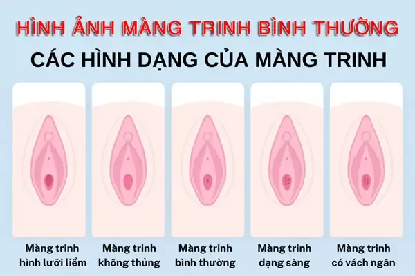 100+ Hình Ảnh Cho Gái Ocn2 Trinh Full Hd Chill Nhất 100+ Hình Ảnh Cho Gái Ocn2 Trinh Full Hd Chill Nhất