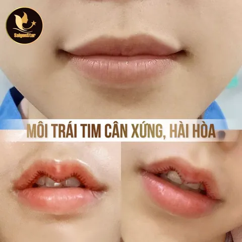 100+ Hình Ảnh Cô Gái Môi Trái Tim 4k, Ảnh Gái Xinh Môi Tim Cực Chất