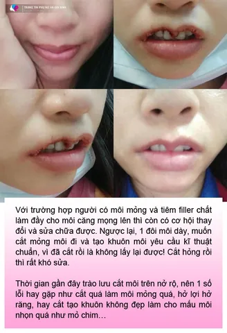 100+ Hình Ảnh Cô Gái Môi Trái Tim 4k, Ảnh Gái Xinh Môi Tim Cực Chất