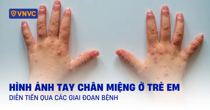 100+ Hình Ảnh Con Gái Cầm Tay Người Khác Full 4k Chất Lượng Cao