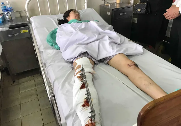 100+ Hình Ảnh Em Gái Nam Viên Ép Tường Gay Gắt Full 4k 100+ Hình Ảnh Em Gái Nam Viên Ép Tường Gay Gắt Full 4k
