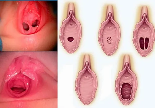 100+ Hình Ảnh Gái Bị Chảy Kinh Đẹp Nhất, 100+ Bức Ảnh Gái Bị Chảy Kinh Cực Kỳ Thực Tế, 100+ Hình Ảnh Gái Bị Chảy Kinh Full Hd Sống Động