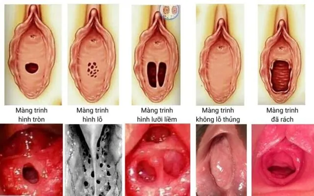 100+ Hình Ảnh Gái Bị Chảy Kinh Đẹp Nhất, 100+ Bức Ảnh Gái Bị Chảy Kinh Cực Kỳ Thực Tế, 100+ Hình Ảnh Gái Bị Chảy Kinh Full Hd Sống Động
