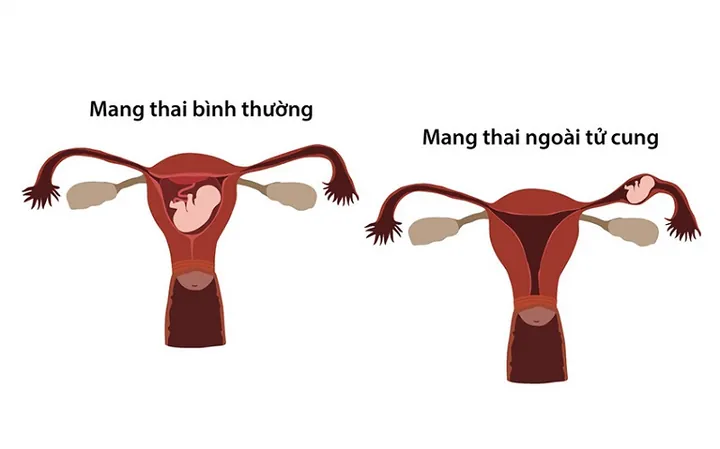 100+ Hình Ảnh Gái Bị Chảy Kinh Đẹp Nhất, 100+ Bức Ảnh Gái Bị Chảy Kinh Cực Kỳ Thực Tế, 100+ Hình Ảnh Gái Bị Chảy Kinh Full Hd Sống Động