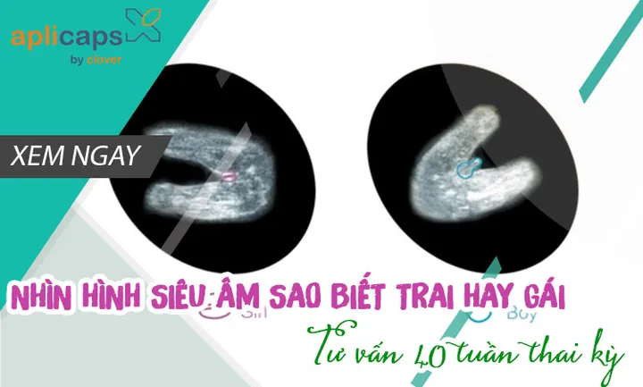 100+ Ảnh Siêu Âm Nhận Biết Trai Gái 4k,100+ Ảnh Dấu Hiệu Trai Gái 100+ Ảnh Siêu Âm Nhận Biết Trai Gái 4k,100+ Ảnh Dấu Hiệu Trai Gái