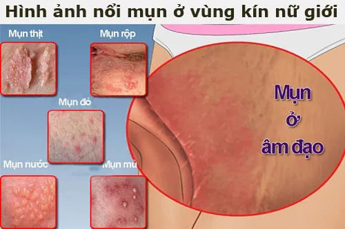 999+ Ảnh Nhìn Hình Ảnh Chổ Kín Của Gái Mới Nhất Hiện Nay