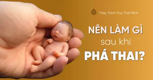 Hướng Dẫn Cách Cúng Vong Nhi Sau Khi Phá Thai: Lễ Vật, Thủ Tục Và Kinh Văn Cầu Siêu Thoát Chi Tiết
